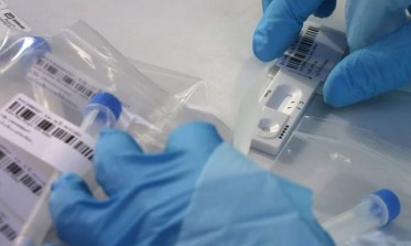 جدري القردة .. تطوير نظام اختبار PCR للكشف عن الإصابة بالفيروس