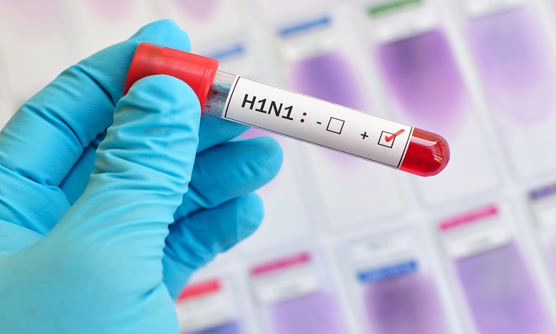 H1N1 : Deux morts selon le ministre de la Santé
