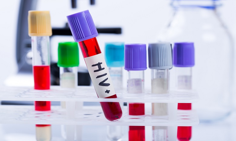 VIH: des chercheurs annoncent un deuxième cas de rémission durable