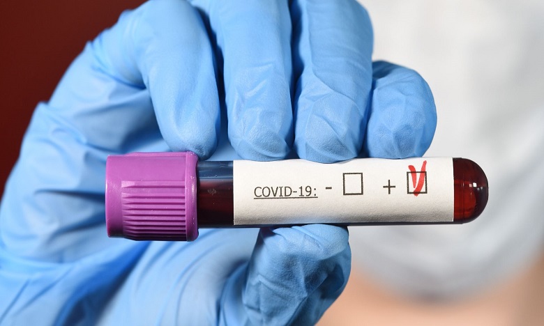 Coronavirus : Deux nouveaux cas confirmés au Maroc