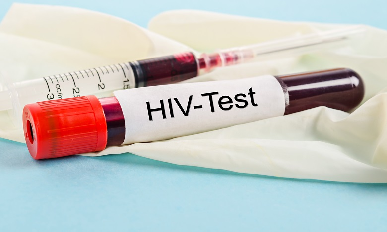 VIH/sida : les interruptions de services de santé liées au Covid-19 pourraient causer une catastrophe humaine