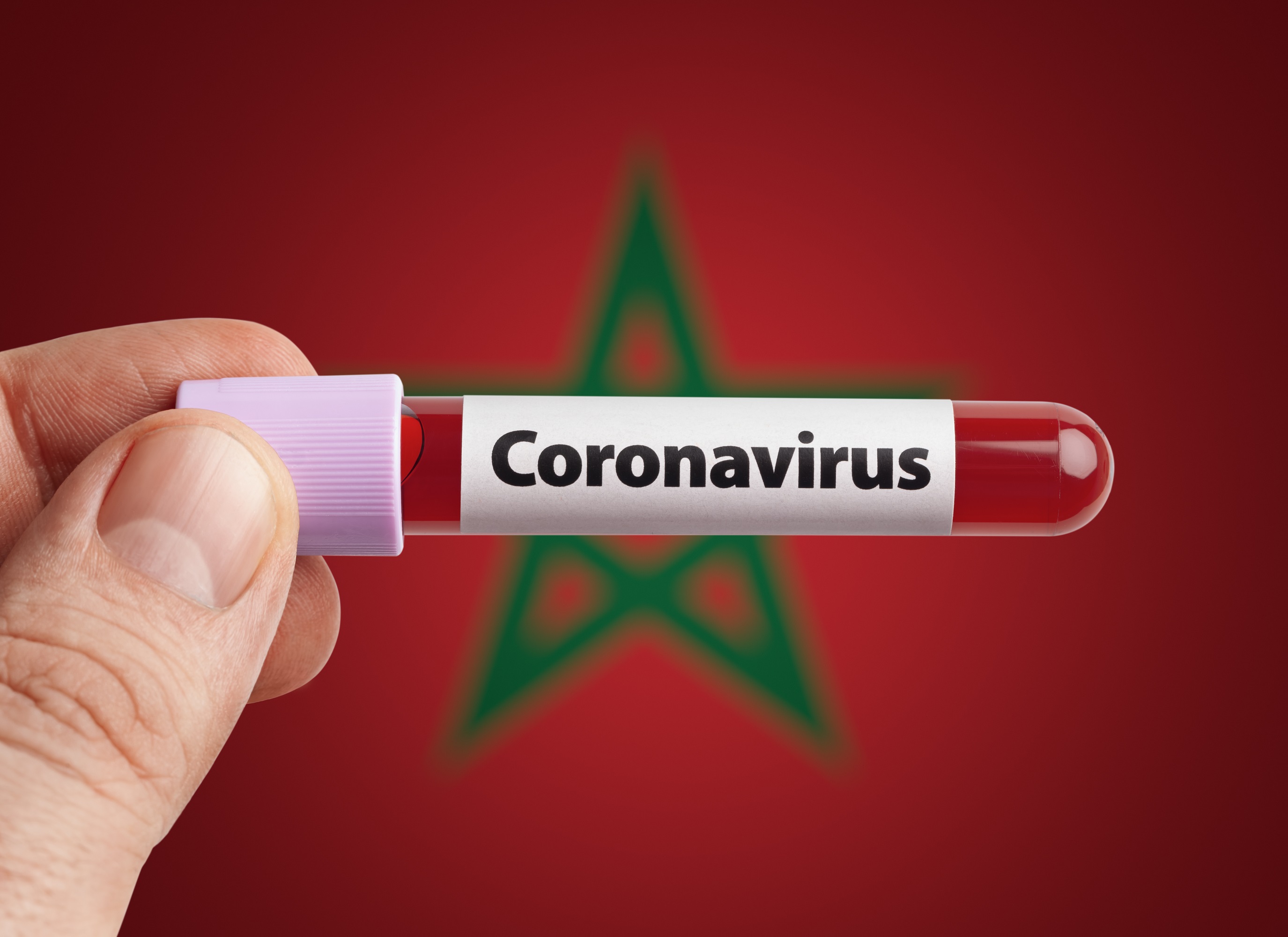 Covid-19: 1.063 nouveaux cas confirmés au Maroc, 347 guérisons, 7 décès en 24H 