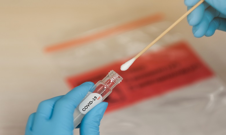 CNSS entame le remboursement des frais liés au Covid-19, sauf les tests PCR
