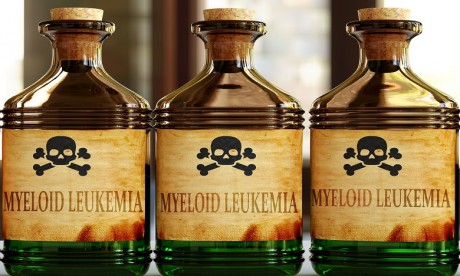 Etude: L'exposition aux pesticides augmente le risque de leucémie myéloïde aiguë