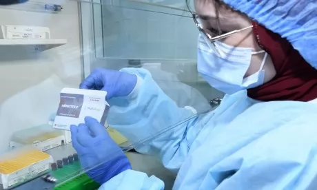 Le kit de diagnostic 100% marocain de l’hépatite C,  bientôt commercialisé à des prix compétitifs