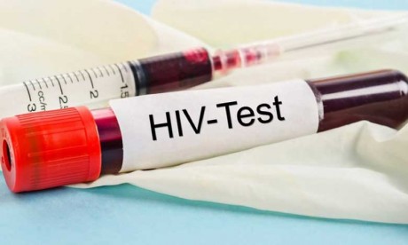 L’ALCS se mobilise pour la promotion du dépistage  du VIH, des IST et des hépatites virales