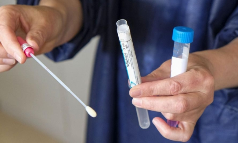 Variole du singe : Roche développe des tests PCR de détection du virus