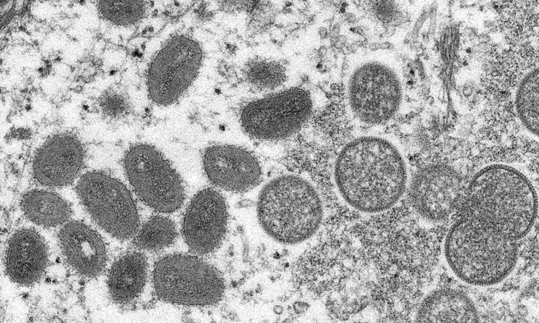 Voici à quoi ressemble la variole du singe observée au microscope. Ph : DR 