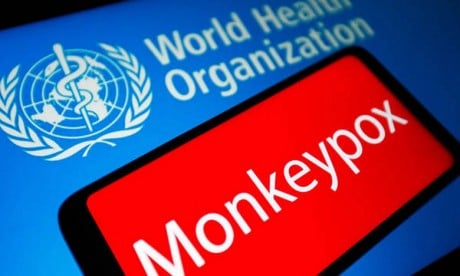 Variole du singe: L'Europe est “l’épicentre” de la flambée des cas (OMS)