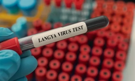 Apparition du virus Langya en Chine : Faut-il s’inquiéter ?