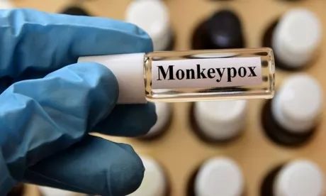 Variole du singe: Des études en cours pour déterminer l’origine de la propagation de la maladie