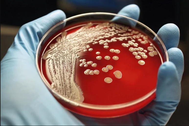 Les infections bactériennes, deuxième cause de décès dans le monde (étude)