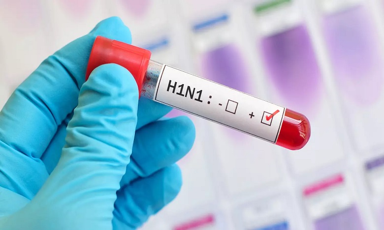 La grippe H1N1 détectée dans toutes les régions de la Russie (autorités sanitaires)