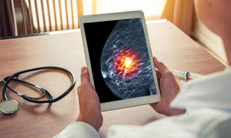 Cancer du sein : l'IA pourrait aider les radiologues dans le dépistage (étude)  